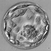 5 day embryo