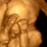 photo of fetus during anatomy scan