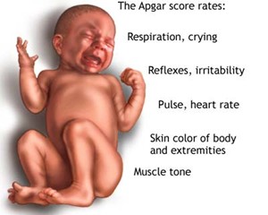 apgar score test