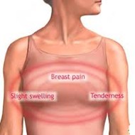 woman with engorged breasts
