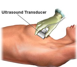 breast ultrasound