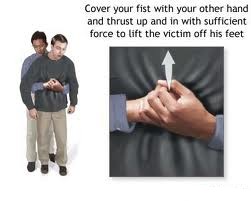 heimlich maneuvre
