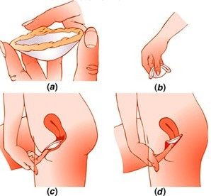 how to use birth control