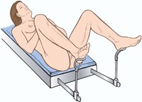 dorsal lithotomy position