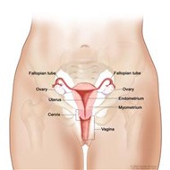 Uterus Cancer