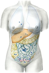 sites of endometriosis growths