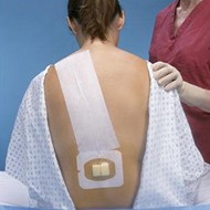 Epidural Pain Relief
