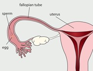 Fallopian Tube Cancer Diagram