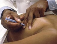 Fine Needle Biopsy