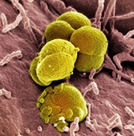 Gonococcus bacteria picture