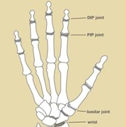 Hand Arhritis Diagram
