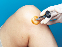 injections