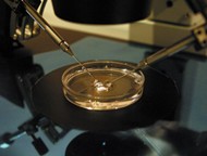 Insemination in Petri Dish