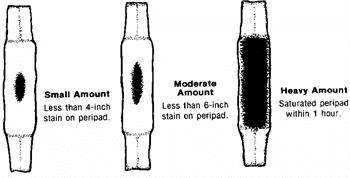 signs of lochia