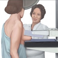 Mammogram Pictures