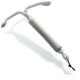 Picture of Mirena Coil