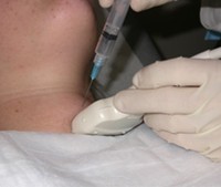 biopsy pictures