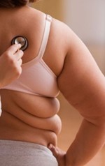 obese woman