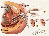 Pap Smear Test