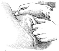 rectovaginal exam