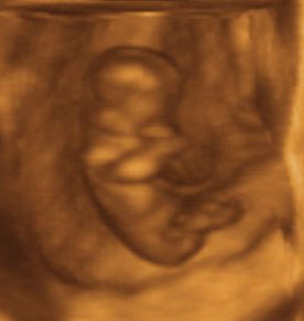 11 weeks 3D