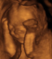 13 weeks