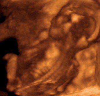 16 weeks 3D