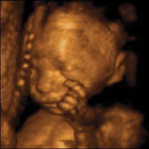 22 weeks