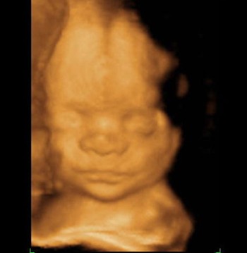 25 weeks