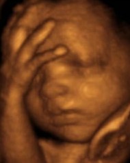 28 weeks
