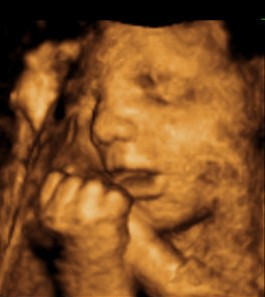 30 weeks