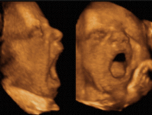 30 weeks