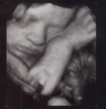 31 weeks
