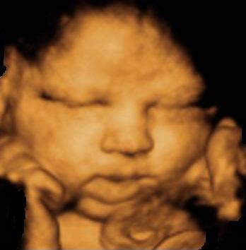 37 weeks