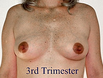 Breast Size 3rd Trimester