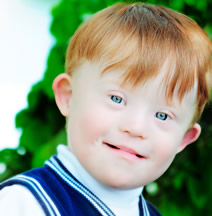 Down Syndrome Boy