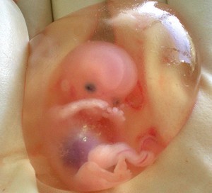10 weeks