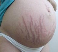 puppps rash