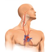 Carotid Scan