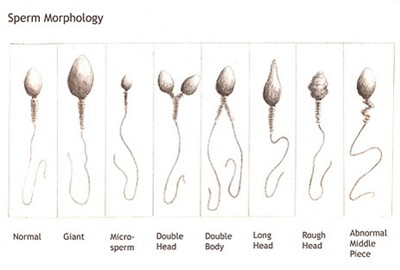 shape of sperm