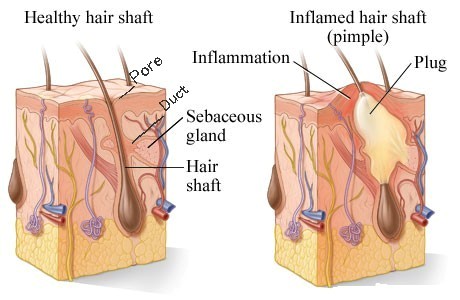 How a spot forms