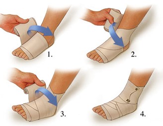 sprained ankle dressing