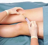 synovial aspiration