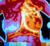 Thermal Image