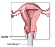 Transvaginal Ultrasound