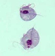 Pictures of trichomoniasis