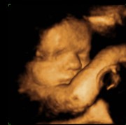 prenatal 4D video