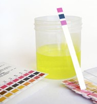 Urinalysis test