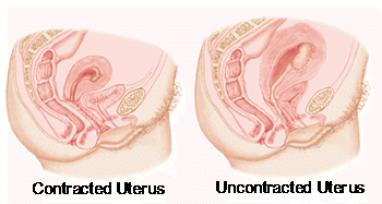 picture of postpartum bleeding