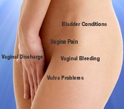 picture of female vaginal area